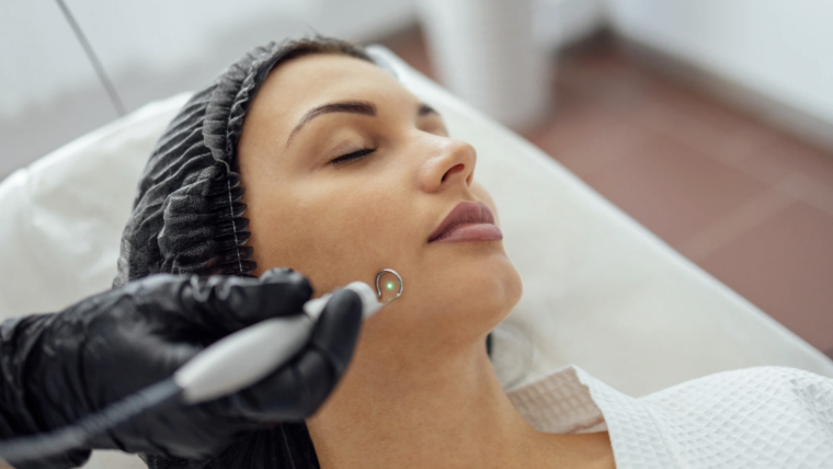 Acne Scar Laser Treatment Costs and Consultations in Arlington, Virginia